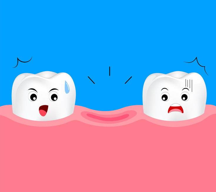 Utraciłeś ząb – co dalej?