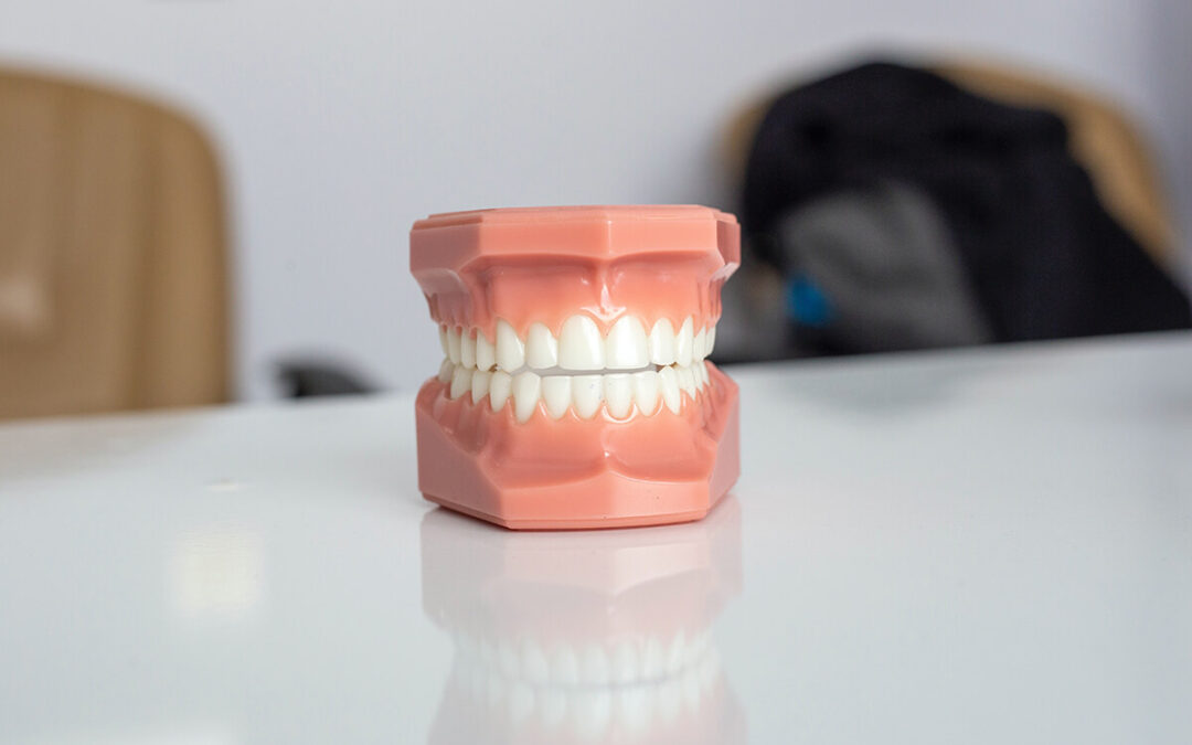 Ekstrakcja zęba – przyczyny, objawy i leczenie