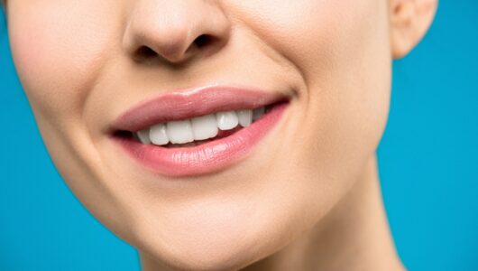 Ile kosztuje wybielanie zębów u dentysty?