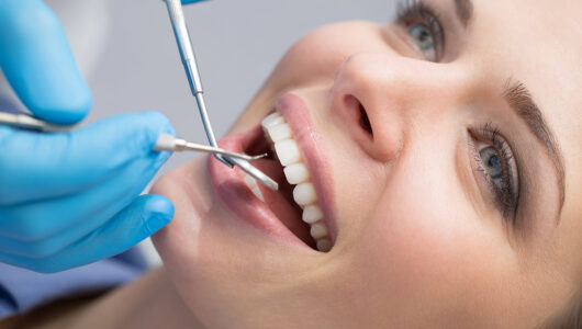 Dlaczego warto regularnie odwiedzać dentystę, nawet gdy nic nie boli?